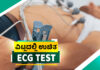 ವಿಟ್ಲದ ಜನತೆಗೆ ಸಂತಸದ ಸುದ್ದಿ: ಜನೌಷಧಿ ಕೇಂದ್ರದಲ್ಲಿ ವಾರದಲ್ಲಿ 3 ದಿನ ಉಚಿತ ಇಸಿಜಿ ಟೆಸ್ಟ್ ಲಭ್ಯ