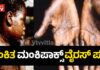 ಕೇರಳದಲ್ಲಿ ಮಂಕಿಪಾಕ್ಸ್ ಪ್ರಕರಣ ಪತ್ತೆ.!