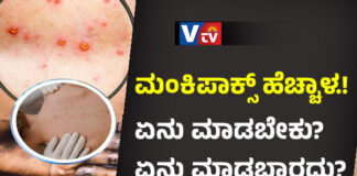 ಮಂಕಿಪಾಕ್ಸ್ ಪ್ರಕರಣ ಹಿನ್ನೆಲೆ: ಕೇಂದ್ರ ಸರ್ಕಾರದಿಂದ ಮಾರ್ಗಸೂಚಿ