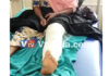 ಬೆಳ್ತಂಗಡಿ: ಅಮಲು ಪದಾರ್ಥ ಸೇವಿಸಿ ಹಲ್ಲೆ ಮಾಡಿ ಪತ್ನಿಯ ಕಾಲು ಮುರಿದ ಭೂಪ