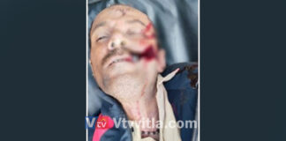 ಉಳ್ಳಾಲ: ಆಸ್ಪತ್ರೆಯ ಸೆಕ್ಯುರಿಟಿ ಗಾರ್ಡ್ ಮೃತದೇಹ ಚರಂಡಿಯಲ್ಲಿ ಪತ್ತೆ
