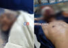 ಪುತ್ತೂರು: ಬೈಕ್ ಅಪಘಾತ; ಪಾದಚಾರಿ ಸಾವು- ಬೈಕ್ ಸವಾರ ಗಂಭೀರ
