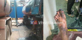 ಮಂಗಳೂರು: ಬಿಟುಮೆನ್ ಆಯಿಲ್ ಫಿಲ್ಲಿಂಗ್ ವೇಳೆ ಭಾರೀ ದುರಂತ; ಪೈಪ್ ಸ್ಟೋಟಗೊಂಡು ನಾಲ್ವರಿಗೆ ಗಾಯ