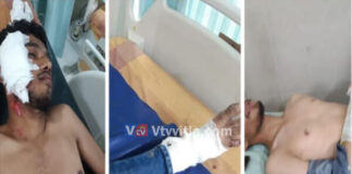 ಮಂಗಳೂರು: ಬೈಕ್ ಮತ್ತು ಕಾರು ಡಿಕ್ಕಿ; ಇಬ್ಬರಿಗೆ ಗಂಭೀರ ಗಾಯ