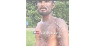 ಉಡುಪಿ: ಪತಿಗೆ ಮೆಣಸಿನ ಹುಡಿ ಮಿಶ್ರಿತ ಕುದಿಯುವ ಬಿಸಿ ನೀರು ಎರಚಿದ ಪತ್ನಿ