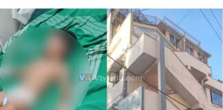 ಹುಟ್ಟುಹಬ್ಬ ಆಚರಣೆ ವೇಳೆ ವಿದ್ಯುತ್ ತಂತಿಗೆ ಬಲೂನ್ ತಗುಲಿ ಬೆಂಕಿ: ನಾಲ್ವರು ಮಕ್ಕಳಿಗೆ ಗಂಭೀರ ಗಾಯ