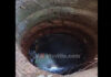 ಮಲ್ಪೆ: ಬಾವಿಗೆ ಹಾರಿ ವ್ಯಕ್ತಿ ಆತ್ಮಹತ್ಯೆ..!