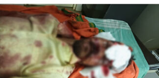 ಬಂಟ್ವಾಳ: ಕಲ್ಲಿನಿಂದ ಹಲ್ಲೆ – ಯುವಕನಿಗೆ ಗಾಯ, ಆರೋಪಿ ವಶಕ್ಕೆ
